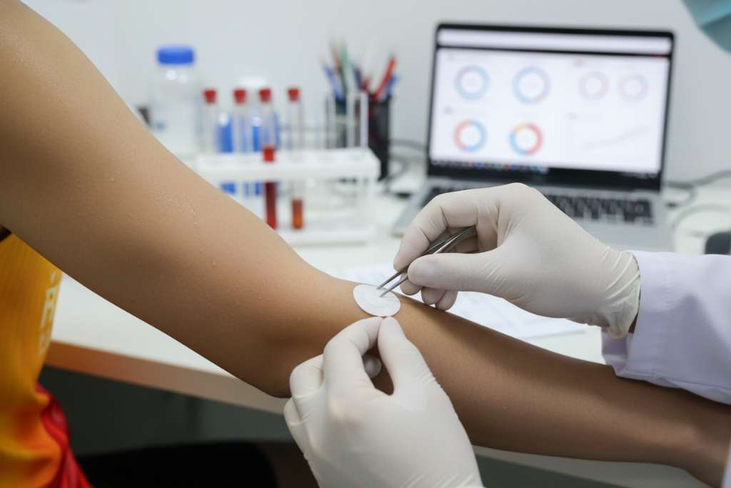 Cận cảnh cẳng tay runner với miếng dán hấp thụ mồ hôi nhỏ hình tròn đang được chuyên gia thể thao dán lên, phía sau là bàn phân tích mẫu với ống nghiệm và laptop hiển thị biểu đồ. Ánh sáng phòng lab sáng đều, góc chụp macro 45 độ, phong cách nhiếp ảnh y khoa thể thao chuyên nghiệp.